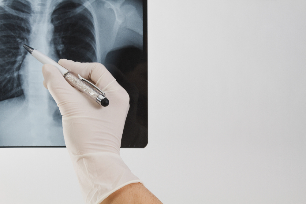 X-ray