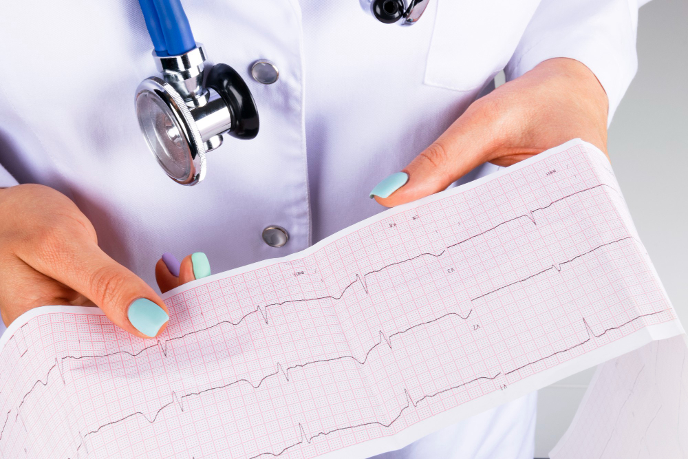 ECG